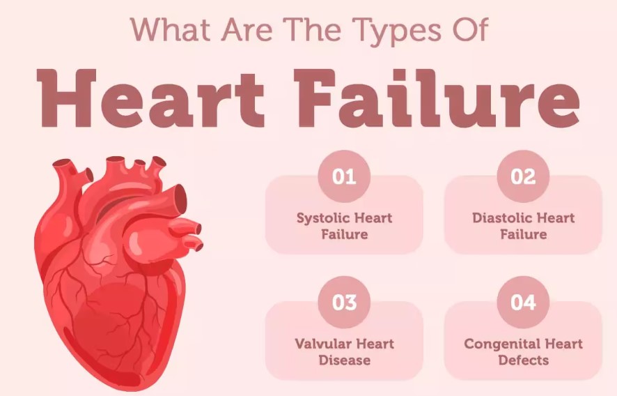 Early Signs of Heart Failure in Adults How Can We Control It Immediately